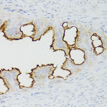 A11343_IHC_01_(26113).jpg