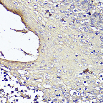 A16275_IHC_01_(27359).jpg