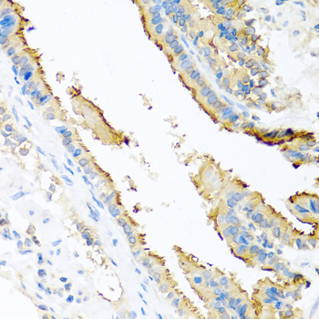 A0304_IHC_03_(8600).jpg